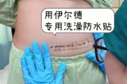 创可贴多久换一次_防水创可贴真的防水吗