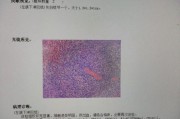 病理诊断准确率如何提高_病理诊断行业未来发展趋势