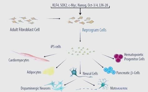 ips细胞治疗哪些疾病_ips细胞临床应用难点