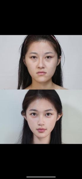 微整形市场前景怎么样_2024年还能赚钱吗