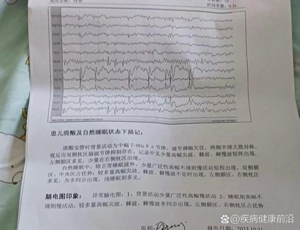 脑电图前景怎么样_脑电图能检查出什么病