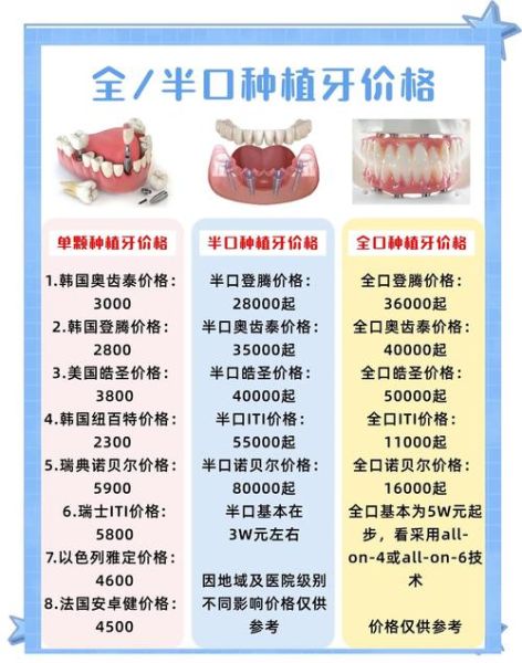 种植牙能用多久_种植牙多少钱一颗
