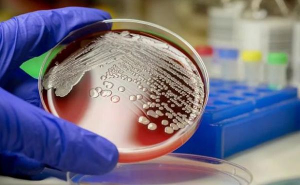 微生物技术就业前景怎么样_微生物专业能做什么工作